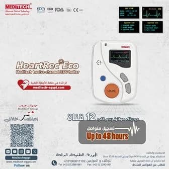 ECG Holter/ 12قناه / مراقبة مستمرة للقلب / تسجيل لمدة 48 ساعة في مصر الجديدة
